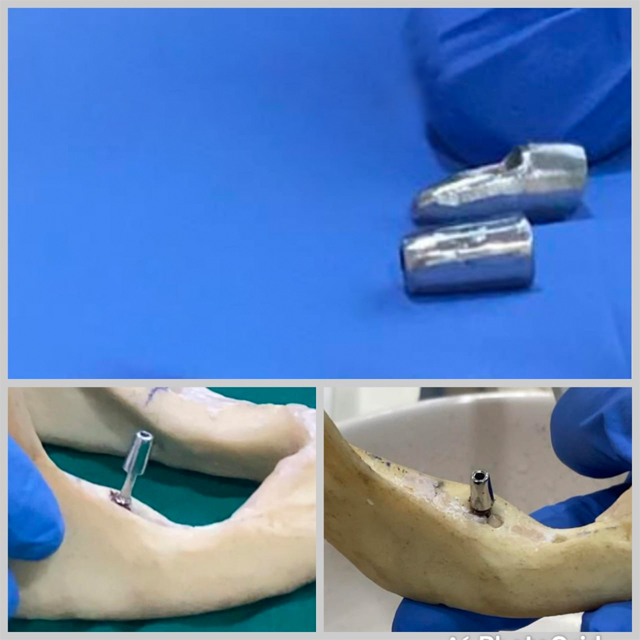 abutment