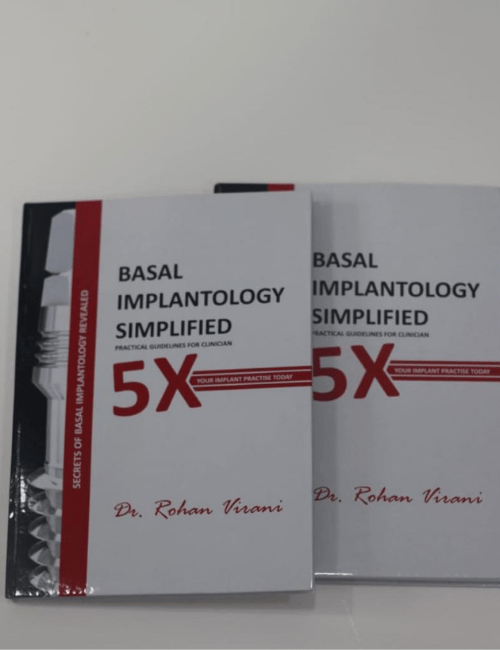 basal implantology simplife dental implant book