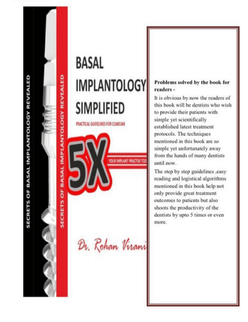 basal implantology simplife 4