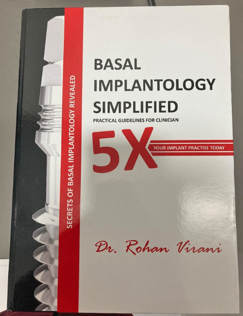 basal implantology simplifed dental implant book