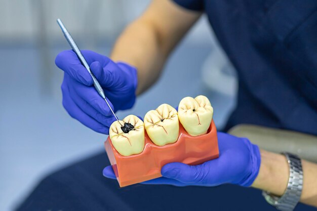 cavity tooth