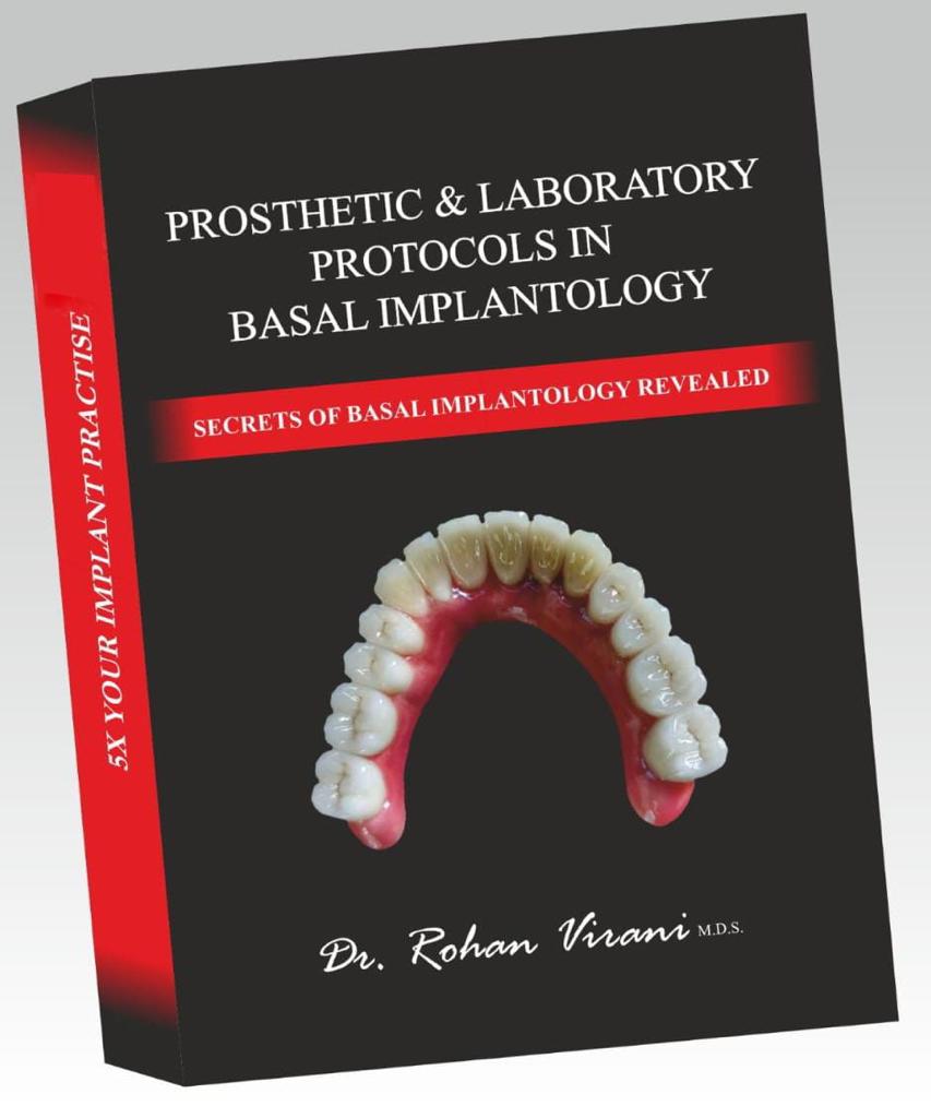 Basal implant prosthetic book image