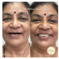 case study female 1
