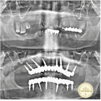 case study female 2