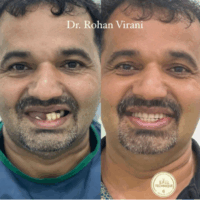 case study male 1